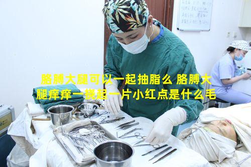 胳膊大腿可以一起抽脂么 胳膊大腿痒痒一挠起一片小红点是什么毛病